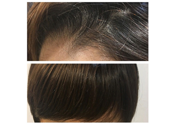 エンジェリックケア